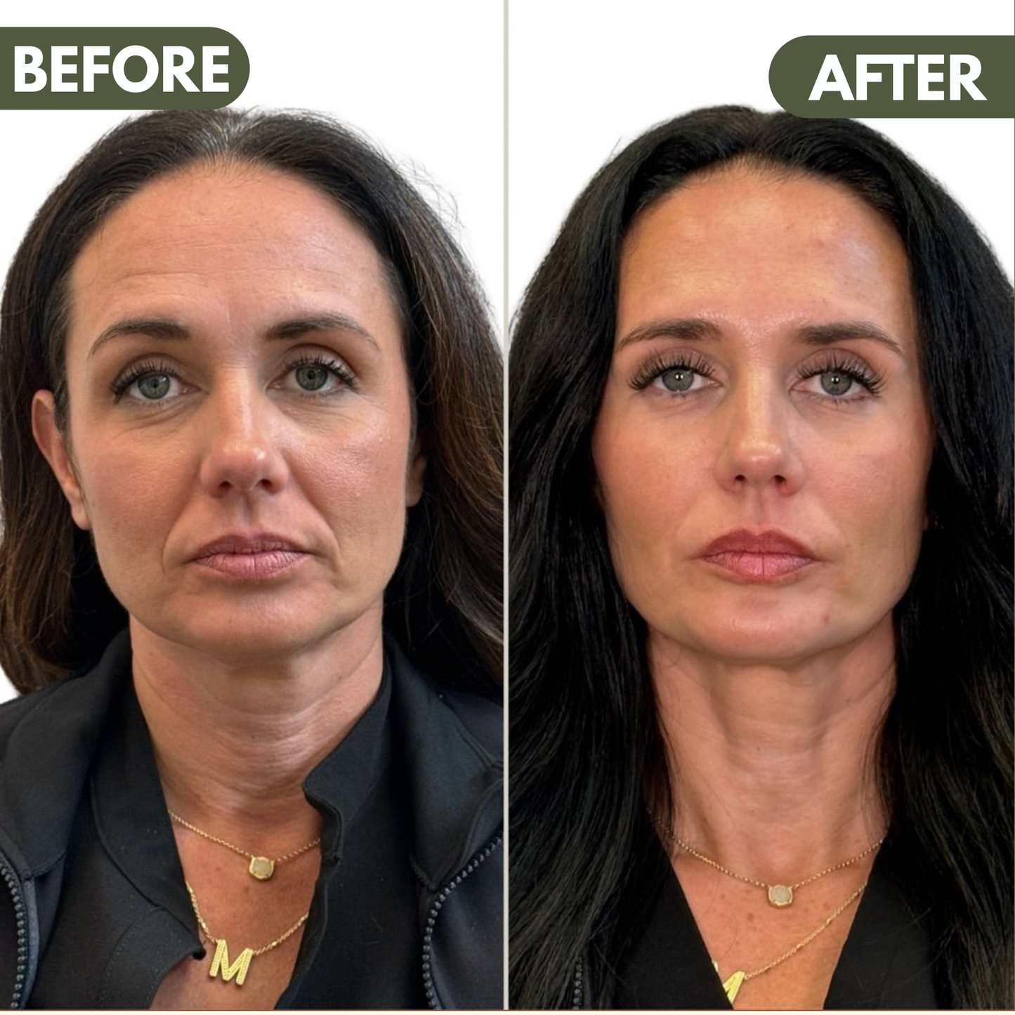 LymiGlow Sculpting Face Brush™