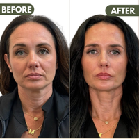 LymiGlow Sculpting Face Brush™