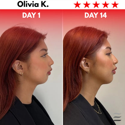 Rejuvify Facial Massager