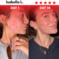 Rejuvify Facial Massager