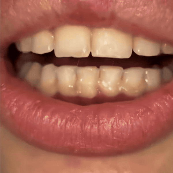 SmileBright Whitening Pen