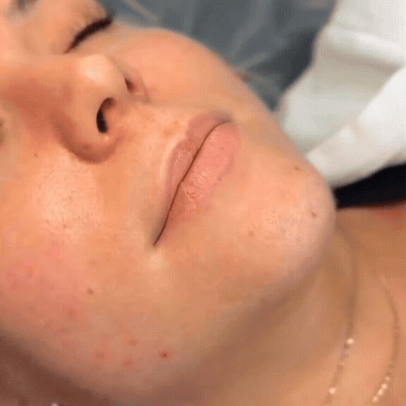 Glow Tulip Lip Enhancer