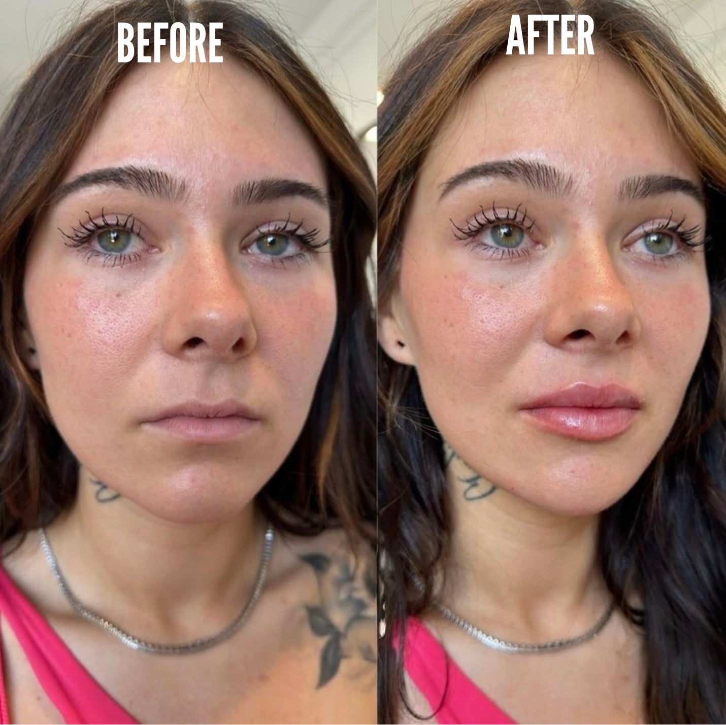 PlumpShot Lip Plumper