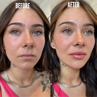 PlumpShot Lip Plumper