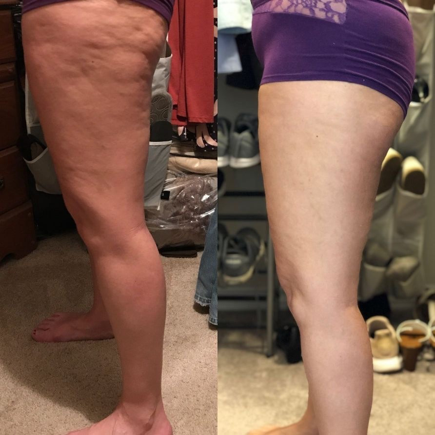 <p>See the Transformation Yourself</p>