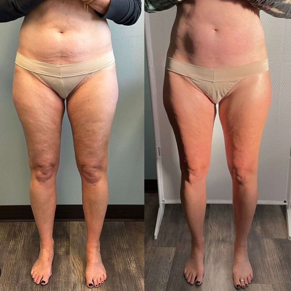 <p>See the Transformation Yourself</p>