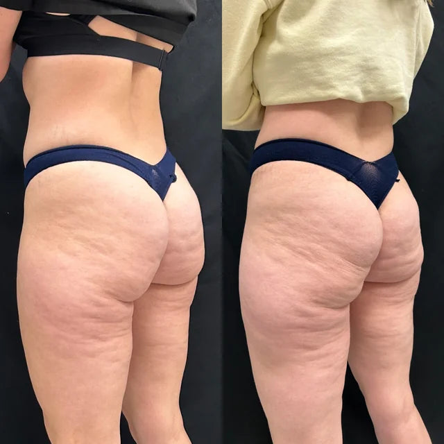 <p>See the Transformation Yourself</p>