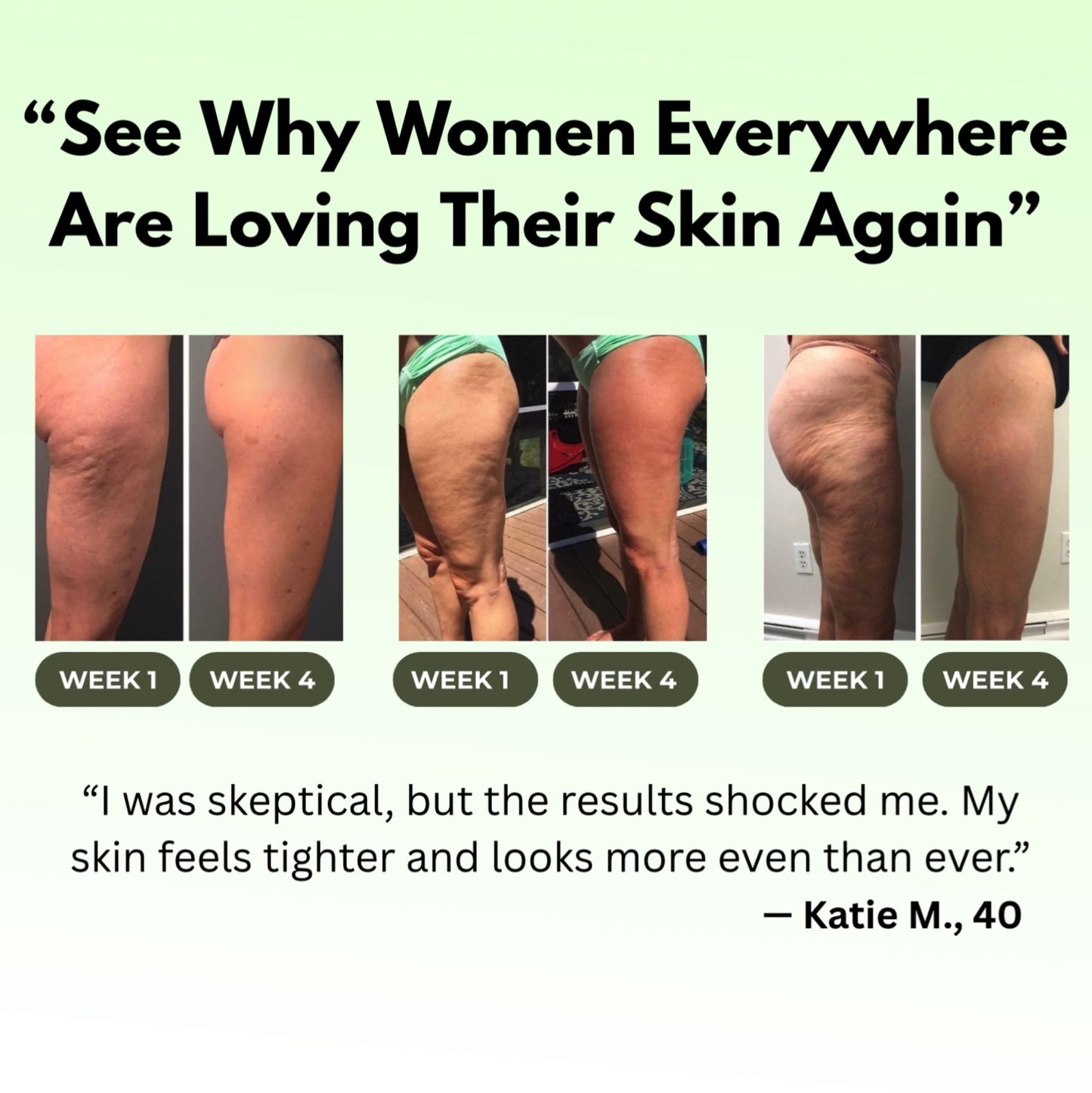 SculptEase Cupping Cellulite Massager™