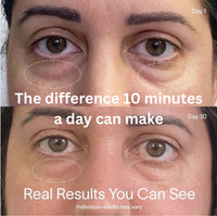 Revive Light Eye Massager