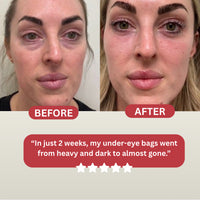 Revive Light Eye Massager