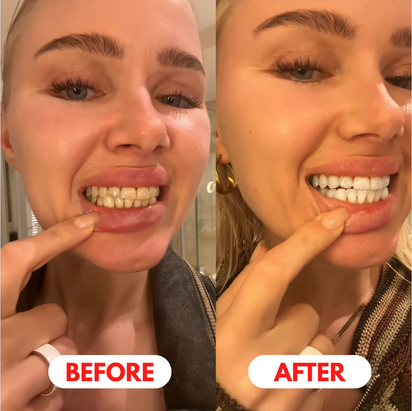 WhiteOral Whitening Pen