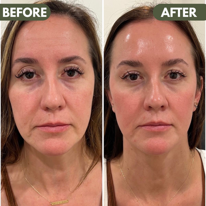 LymiGlow Sculpting Face Brush™