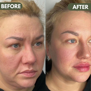 Reveal Your Best, Radiant Skin Today!